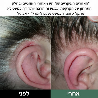 Lissima – פילינג טבעי לקרקפת