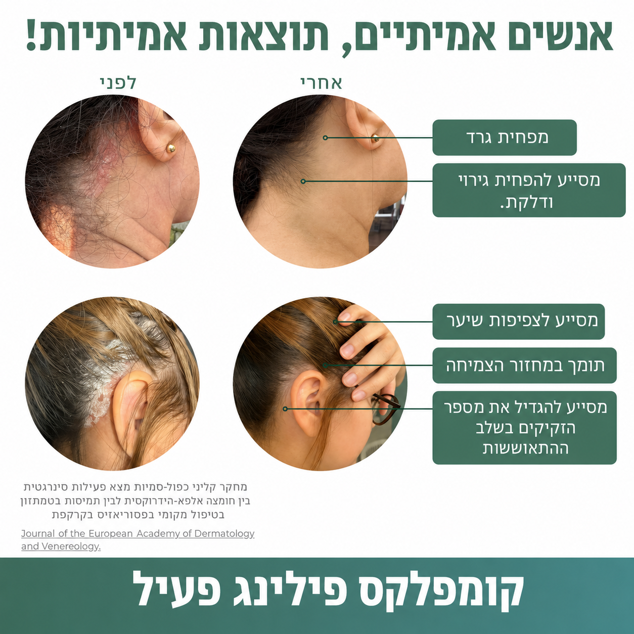 Lissima – פילינג טבעי לקרקפת